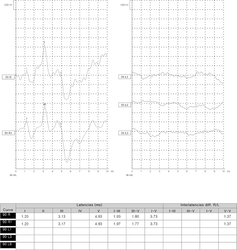 jkmood-34-3-80-g3